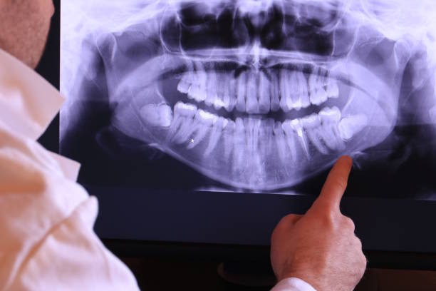 Best Emergency Treatment for Dental Infections or Abscesses in Grace, ID